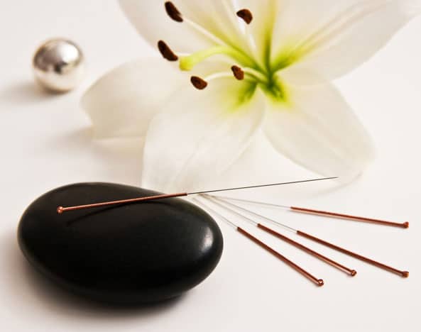 acupuncture needles and hot stone