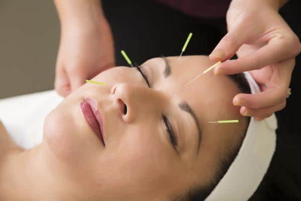 woman getting an acupuncture facial