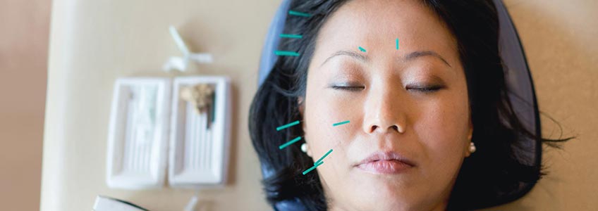 woman getting an acupuncture facial