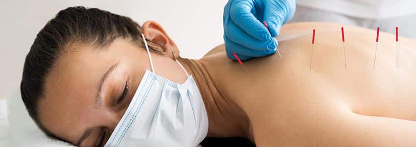 man placing acupuncture needles in womans back