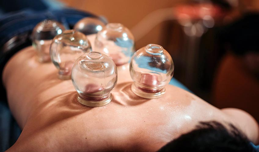 man getting cupping massage on back