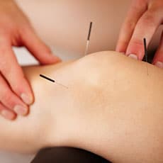 person getting acupuncture in knee